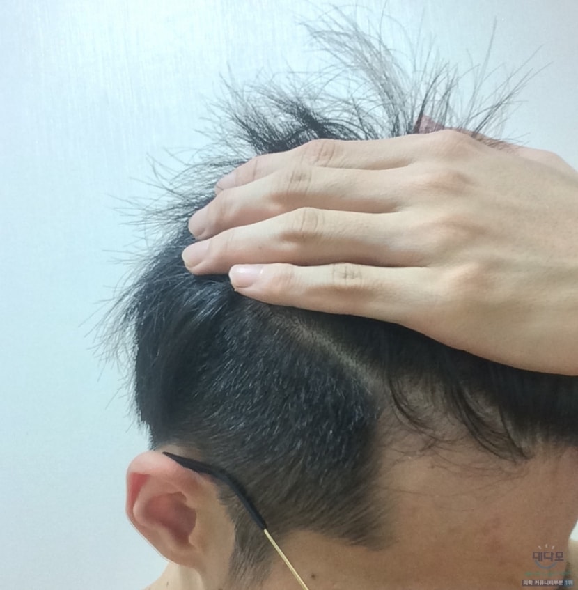 예전이마