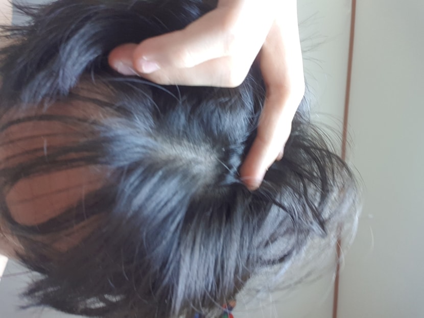 앞부분머리