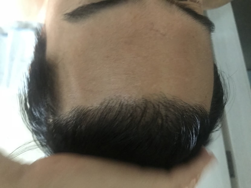 헤어라인