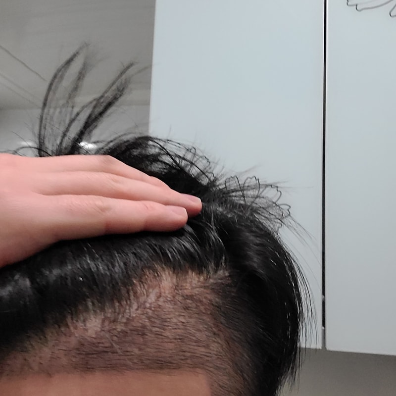 후1.jpg