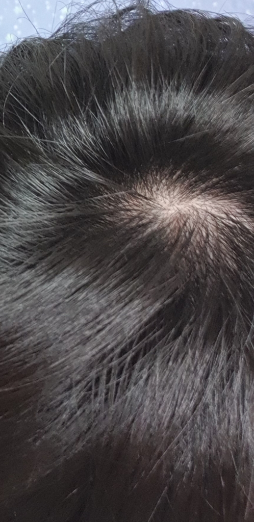 Screenshot_20190617-193610_Gallery.jpg
