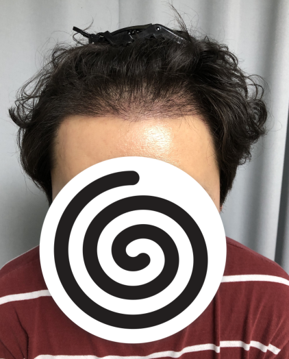 1.PNG