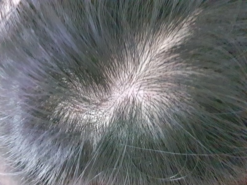 20201204_181125.jpg