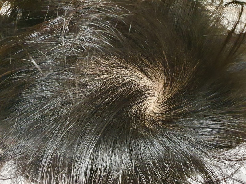 20211107_203436.jpg