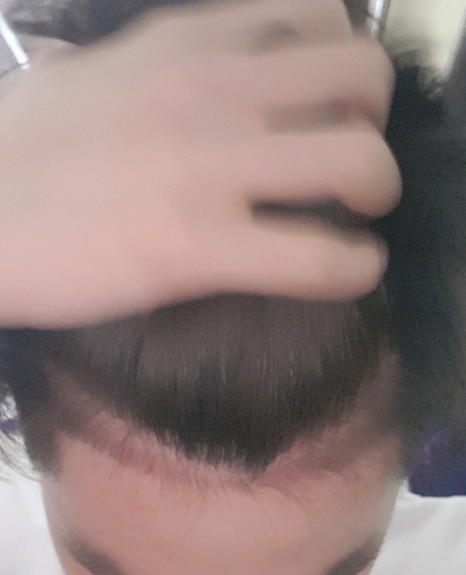 20180423_212703.jpg