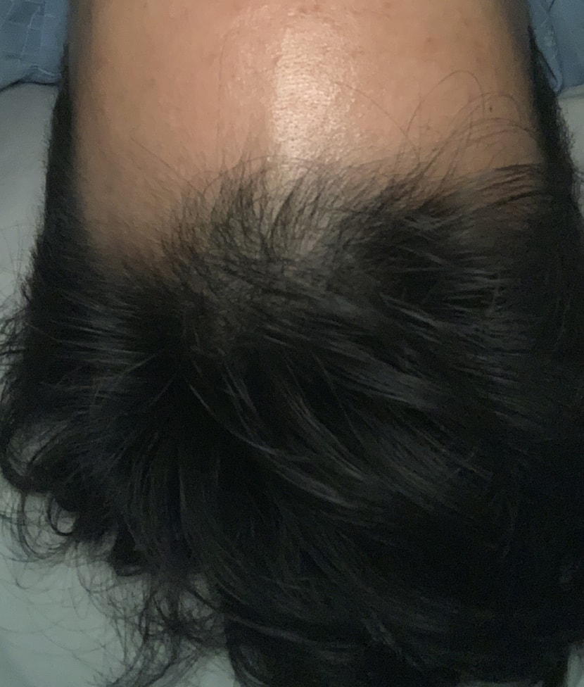 2개월 후