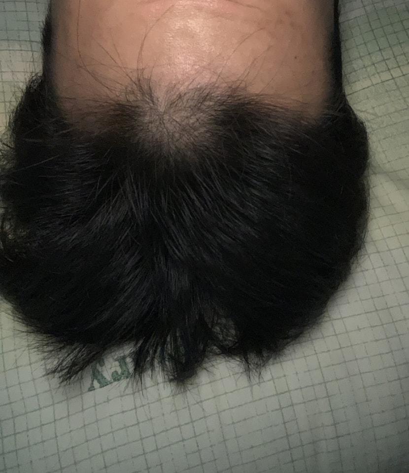 약복용전