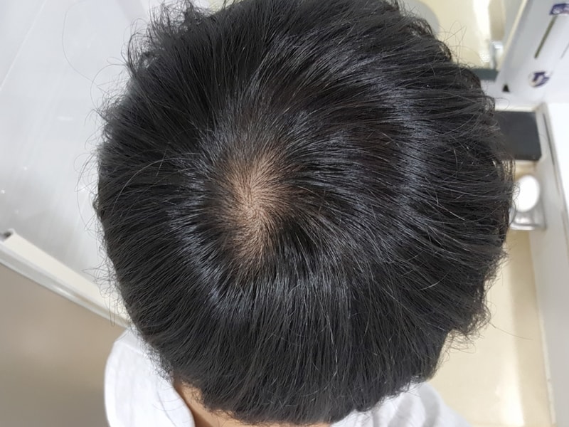 20180825_123530.jpg