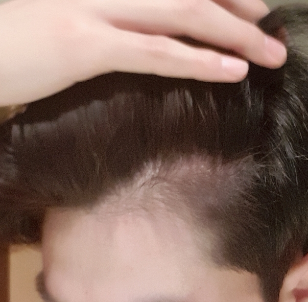 20180216_200626.jpg