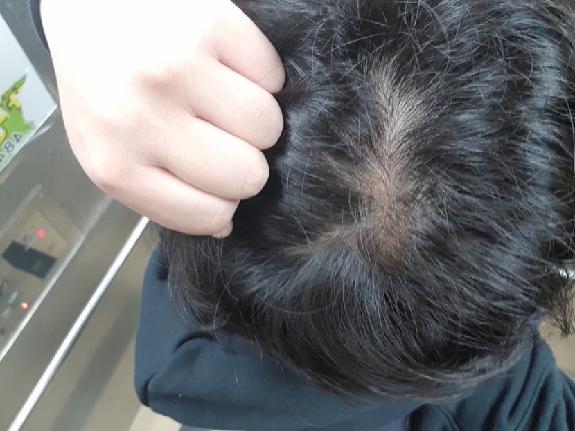 잡아당긴경우
