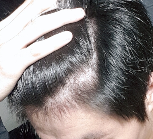 20180921_110800.jpg
