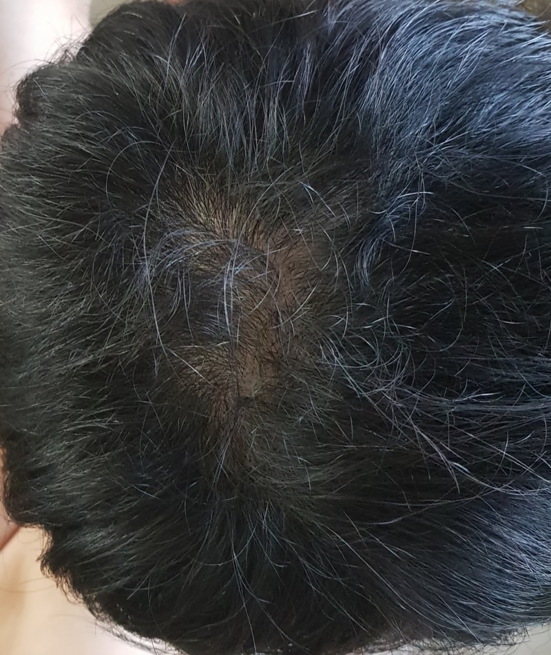20180721_101153.jpg