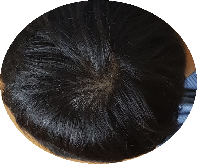 SmartSelect_20181126-014837_Gallery.png