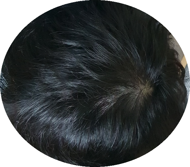 SmartSelect_20181126-014902_Gallery.png