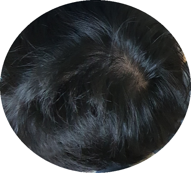 SmartSelect_20181126-014916_Gallery.png