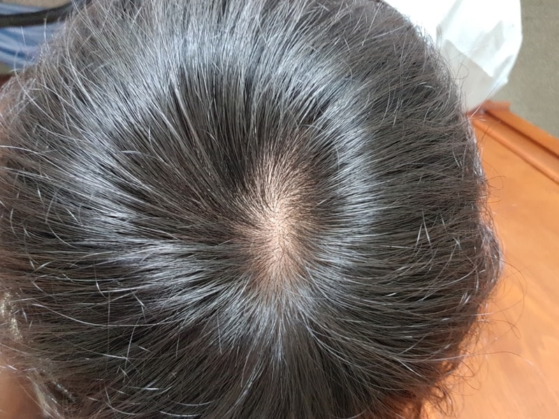 20180713_095737.jpg