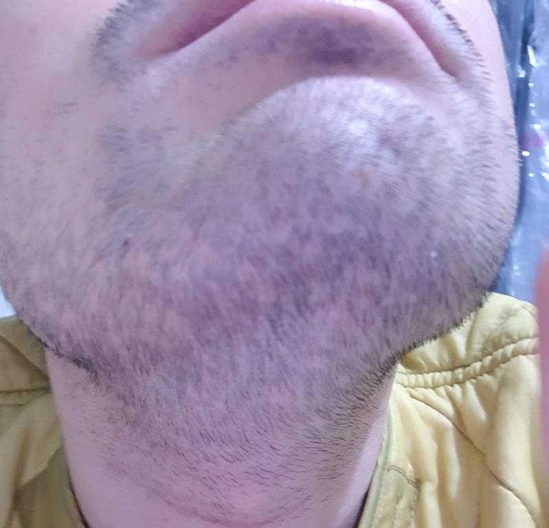 3690641585_Zizh3vIV_6d912885e59ec91b84fa5e131c8199d64c32f5fa.jpg