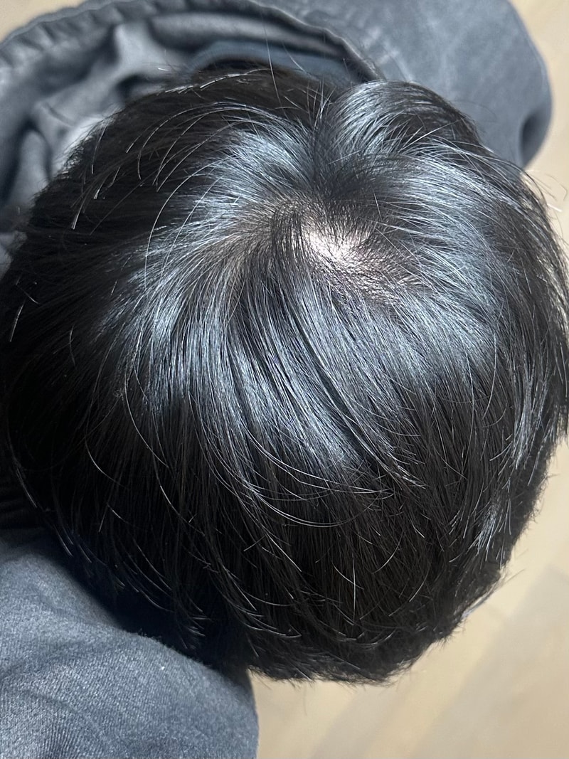 병원 세군데 다녀왔는데 말이 다른데 어떻게 해야하나요,,,?
