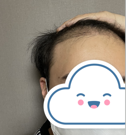 2.PNG