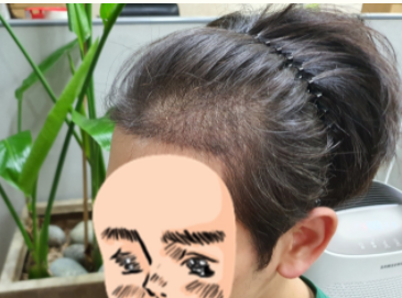 1.PNG