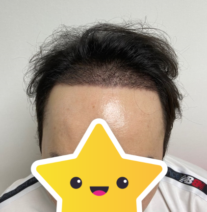 후 1.PNG