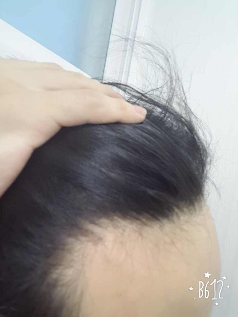 B612_20160807_193844.jpg