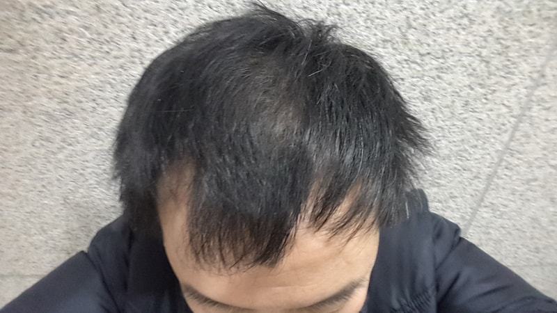 20170221_105200.jpg