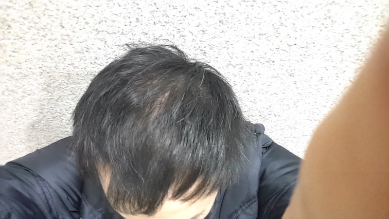 20170221_105251.jpg