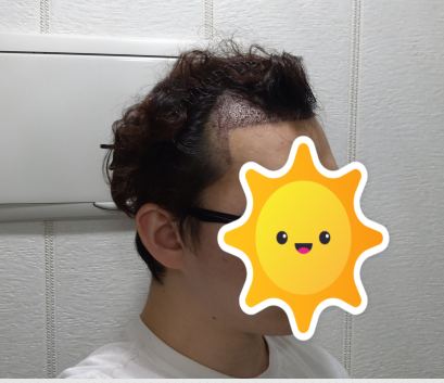 후3.PNG