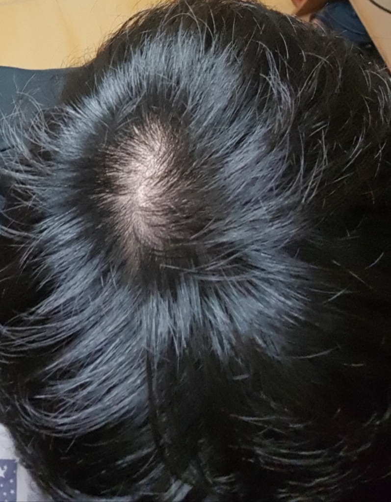 20180520_174317.jpg