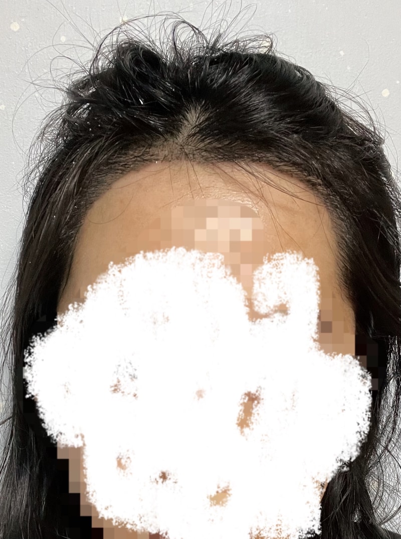 후1.jpg
