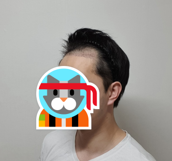 이치훈 후 3.PNG