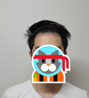 이치훈 후 1.PNG