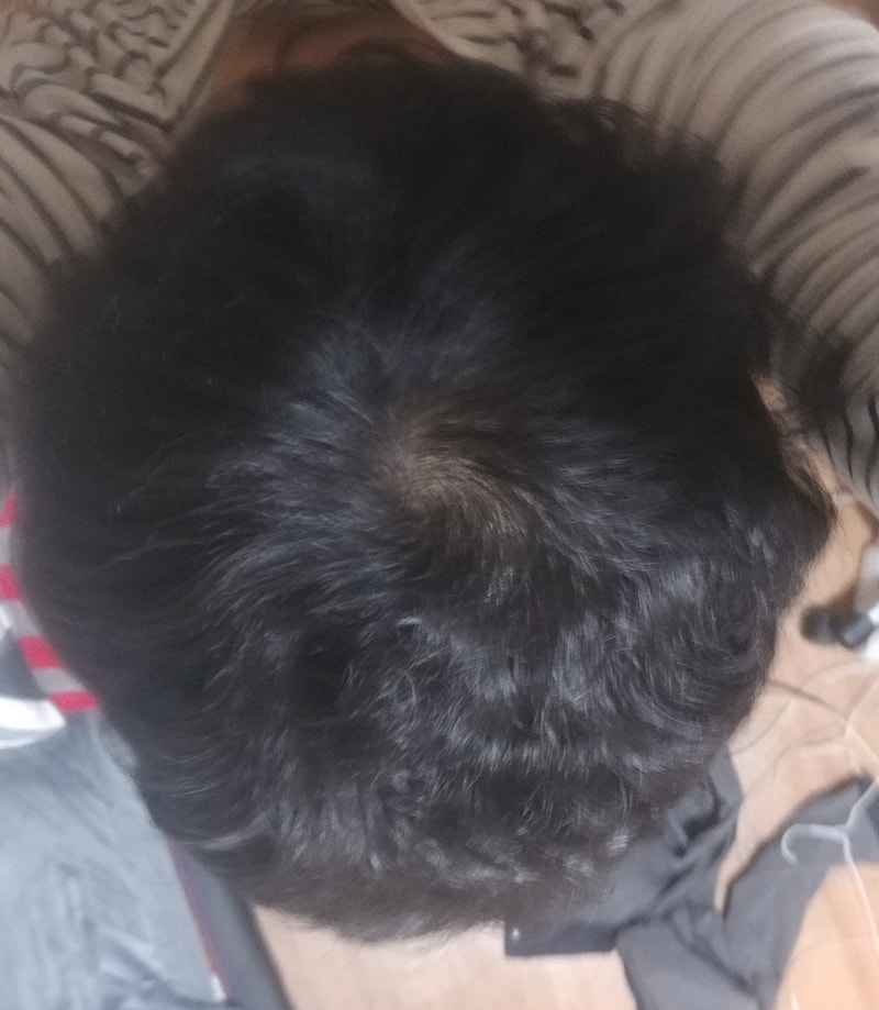 20170309_204143-1.jpg