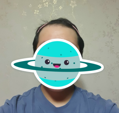 정기연 수술 전 1.PNG