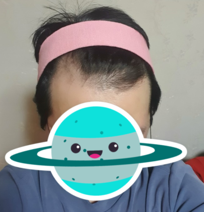 정기연 수술 전 3.PNG