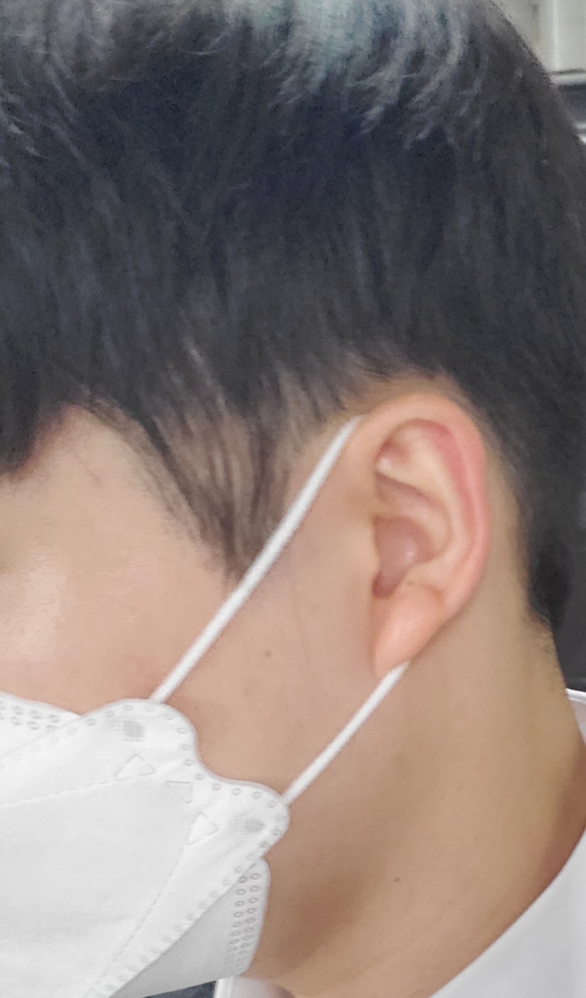 문제있는 오른쪽