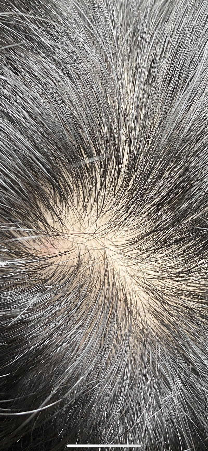 87CFCF49-DF3B-44B5-9B37-82DC57F213C3.png
