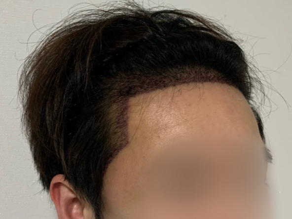 후 2.PNG