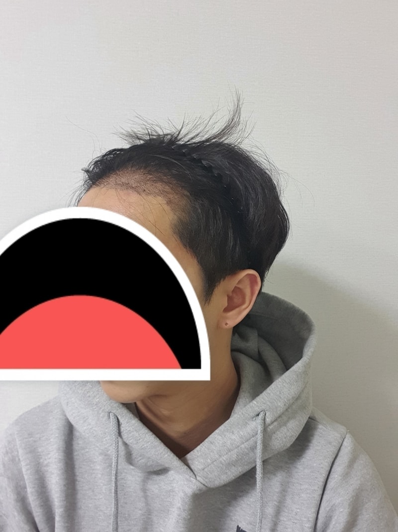 후1.jpg