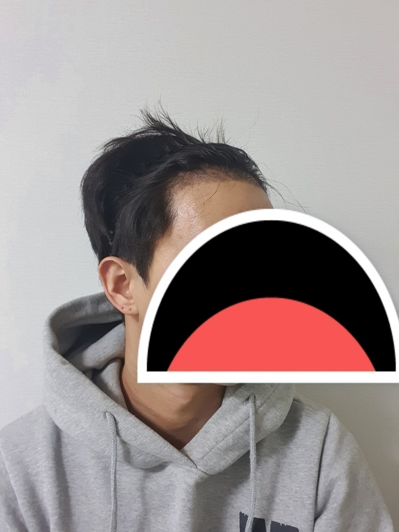 후3.jpg