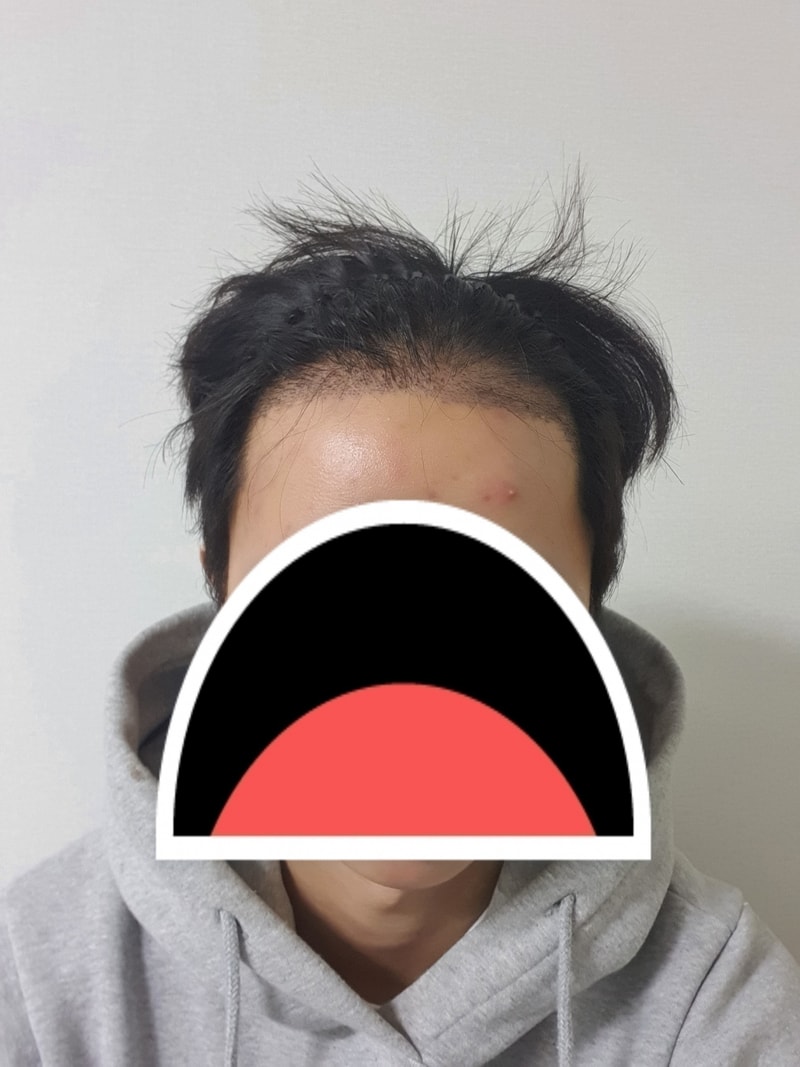 후2.jpg