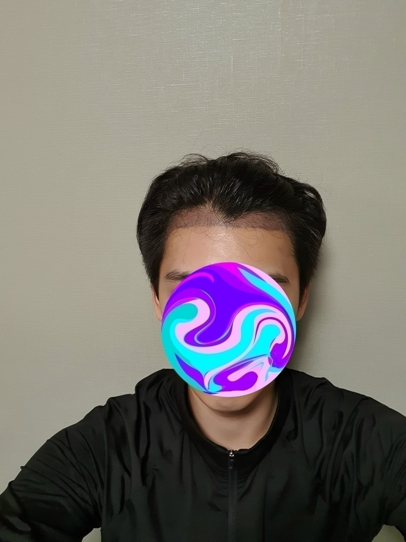 앞모습