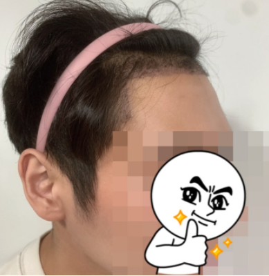 박호렬 수술후 1.PNG