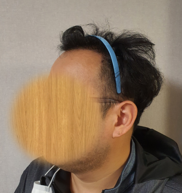 &lt;후&gt;