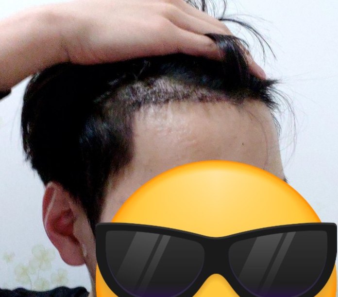 양민우 4.PNG