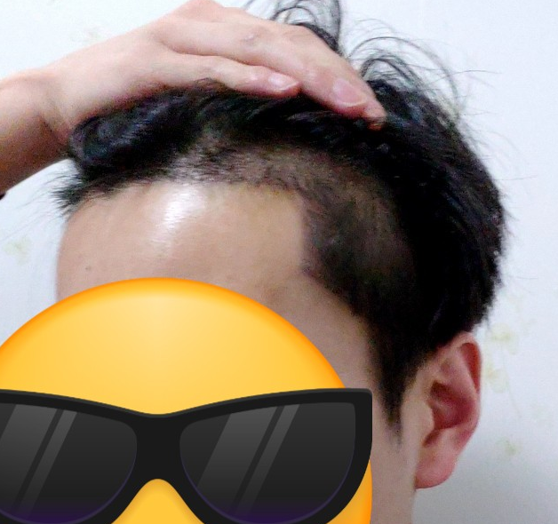 양민우 2.PNG
