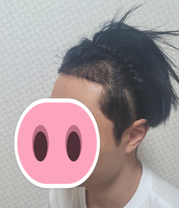 후 3.PNG