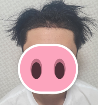 후 1.PNG