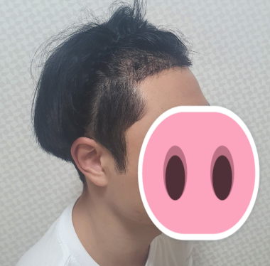 후 2.PNG
